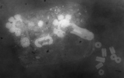 Röntgenaufnahme eines Tascheninhalts aus dem Gräberfeld Bedburg-Königshoven.